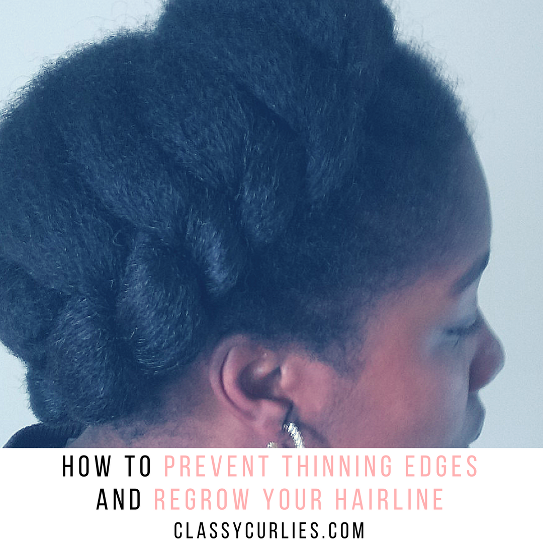 How To Prevent Thinning Edges And Regrow Your Hairline